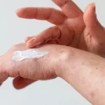 Percaya Diri Dengan Body Lotion: Solusi Alami Untuk Bekas Luka