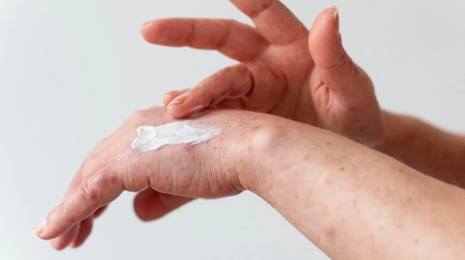 Percaya Diri Dengan Body Lotion: Solusi Alami Untuk Bekas Luka