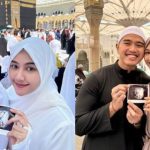 Publik Heboh! Kabar Kehamilan Erina Gudono Jadi Perbincangan