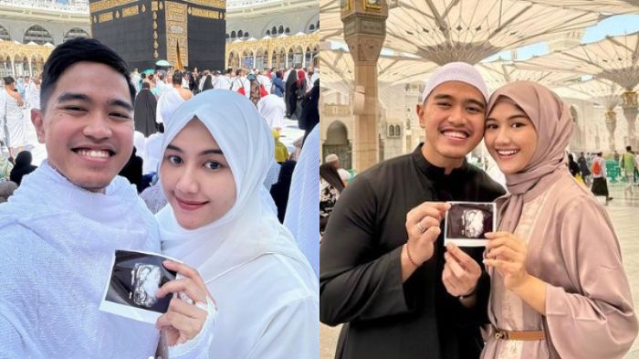 Publik Heboh! Kabar Kehamilan Erina Gudono Jadi Perbincangan